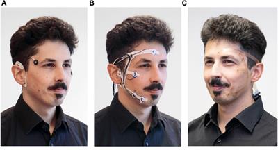 Pre-gelled Electrode Grid for Self-Applied EEG Sleep Monitoring at Home